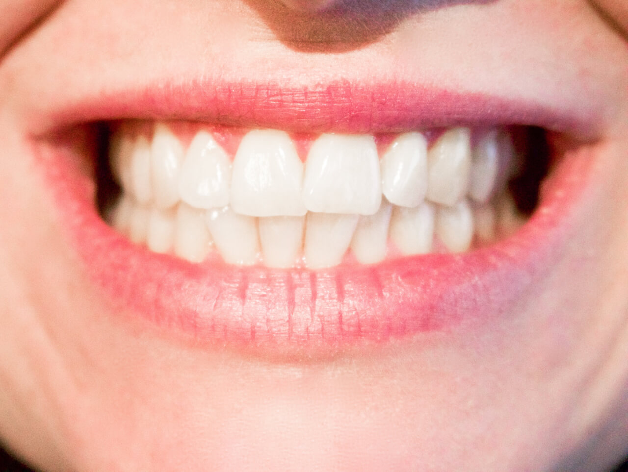 women-white-teeth